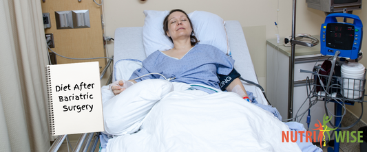 Bariatric Surgery Diet